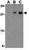 Caspase 7 antibody, GTX31704, GeneTex, Western Blot image 