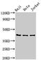 Phosphoprotein Membrane Anchor With Glycosphingolipid Microdomains 1 antibody, LS-C674887, Lifespan Biosciences, Western Blot image 