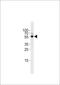 Transforming Growth Factor Beta 2 antibody, LS-B13193, Lifespan Biosciences, Western Blot image 