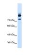 Myotubularin Related Protein 1 antibody, orb330223, Biorbyt, Western Blot image 