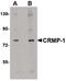 Collapsin Response Mediator Protein 1 antibody, PA5-20677, Invitrogen Antibodies, Western Blot image 