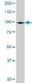 GRIP And Coiled-Coil Domain Containing 1 antibody, H00079571-B01P, Novus Biologicals, Western Blot image 