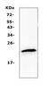 Transmembrane Protein 107 antibody, A04966, Boster Biological Technology, Western Blot image 