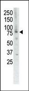 Muscle Associated Receptor Tyrosine Kinase antibody, 63-114, ProSci, Western Blot image 