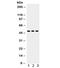 Sequestosome 1 antibody, R32218, NSJ Bioreagents, Western Blot image 