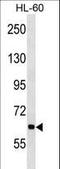 Ankyrin Repeat And KH Domain Containing 1 antibody, LS-C156340, Lifespan Biosciences, Western Blot image 