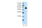 ETS Proto-Oncogene 2, Transcription Factor antibody, 31-170, ProSci, Western Blot image 