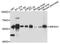 Inosine Monophosphate Dehydrogenase 1 antibody, A03791, Boster Biological Technology, Western Blot image 