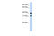 Chitinase Acidic antibody, 31-283, ProSci, Enzyme Linked Immunosorbent Assay image 