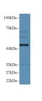 WRS antibody, LS-C296834, Lifespan Biosciences, Western Blot image 