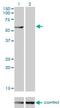 Chaperonin Containing TCP1 Subunit 8 Like 2 antibody, H00150160-M01, Novus Biologicals, Western Blot image 