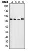 Serum/Glucocorticoid Regulated Kinase 1 antibody, LS-C352829, Lifespan Biosciences, Western Blot image 