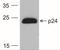 HIV-1 gp24 antibody, NBP2-41341, Novus Biologicals, Western Blot image 