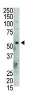 MDM2 Proto-Oncogene antibody, abx026880, Abbexa, Western Blot image 
