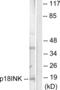 Cyclin Dependent Kinase Inhibitor 2C antibody, abx013164, Abbexa, Western Blot image 