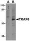 TNF Receptor Associated Factor 6 antibody, NBP1-77230, Novus Biologicals, Western Blot image 