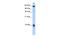 S100 Calcium Binding Protein A3 antibody, PA5-42097, Invitrogen Antibodies, Western Blot image 