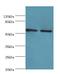 3-Oxoacid CoA-Transferase 1 antibody, LS-C376253, Lifespan Biosciences, Western Blot image 