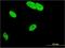 Mediator of RNA polymerase II transcription subunit 9 antibody, H00055090-M03, Novus Biologicals, Immunocytochemistry image 