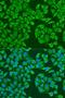 Insulin Like Growth Factor 2 MRNA Binding Protein 3 antibody, LS-C746854, Lifespan Biosciences, Immunofluorescence image 