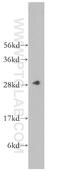 Carbonic Anhydrase 1 antibody, 13198-2-AP, Proteintech Group, Western Blot image 