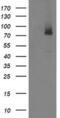 IlvB Acetolactate Synthase Like antibody, MA5-25587, Invitrogen Antibodies, Western Blot image 
