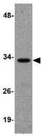 Ribonuclease H2 Subunit A antibody, GTX85020, GeneTex, Western Blot image 