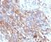 Neural Cell Adhesion Molecule 1 antibody, V7149IHC-7ML, NSJ Bioreagents, Immunohistochemistry paraffin image 