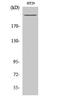 RNA Polymerase II Subunit A antibody, STJ95538, St John