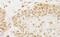 Protein Phosphatase 5 Catalytic Subunit antibody, NB110-40555, Novus Biologicals, Immunohistochemistry paraffin image 