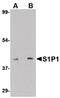 Sphingosine-1-Phosphate Receptor 1 antibody, PA5-20610, Invitrogen Antibodies, Western Blot image 