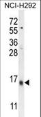 Lymphocyte Antigen 6 Family Member G6C antibody, LS-C163931, Lifespan Biosciences, Western Blot image 