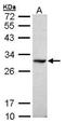 Activation Induced Cytidine Deaminase antibody, NBP1-30955, Novus Biologicals, Western Blot image 