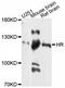 HR Lysine Demethylase And Nuclear Receptor Corepressor antibody, A11996, ABclonal Technology, Western Blot image 