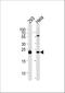 Interleukin 1 Receptor Antagonist antibody, A00651, Boster Biological Technology, Western Blot image 