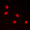 Transcription Factor Dp-1 antibody, LS-C352923, Lifespan Biosciences, Immunofluorescence image 