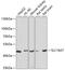 Solute Carrier Family 16 Member 7 antibody, A05214, Boster Biological Technology, Western Blot image 