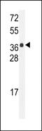 Harbinger Transposase Derived 1 antibody, PA5-48133, Invitrogen Antibodies, Western Blot image 