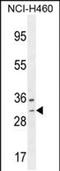 WBSCR27 antibody, PA5-48112, Invitrogen Antibodies, Western Blot image 