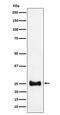 Adenylate Kinase 4 antibody, M07383-1, Boster Biological Technology, Western Blot image 