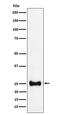 Adenylate kinase isoenzyme 4, mitochondrial antibody, M07383-1, Boster Biological Technology, Western Blot image 