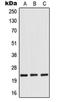RAN Binding Protein 1 antibody, orb214495, Biorbyt, Western Blot image 
