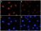 Ribosomal Protein S6 Kinase A1 antibody, MAB79671, R&D Systems, Immunocytochemistry image 