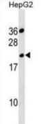 Transmembrane protease serine 11B-like protein antibody, abx030768, Abbexa, Western Blot image 