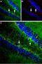 Solute Carrier Family 1 Member 3 antibody, PA5-77426, Invitrogen Antibodies, Immunohistochemistry frozen image 