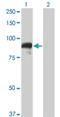 DNA Topoisomerase III Beta antibody, H00008940-M05, Novus Biologicals, Western Blot image 