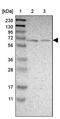 Myotubularin 1 antibody, PA5-52725, Invitrogen Antibodies, Western Blot image 