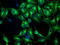 Tubulin Beta 4A Class IVa antibody, LS-B13036, Lifespan Biosciences, Immunofluorescence image 