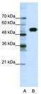 Chloride Voltage-Gated Channel Kb antibody, TA338388, Origene, Western Blot image 