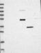 WD Repeat Domain 34 antibody, NBP1-88806, Novus Biologicals, Western Blot image 